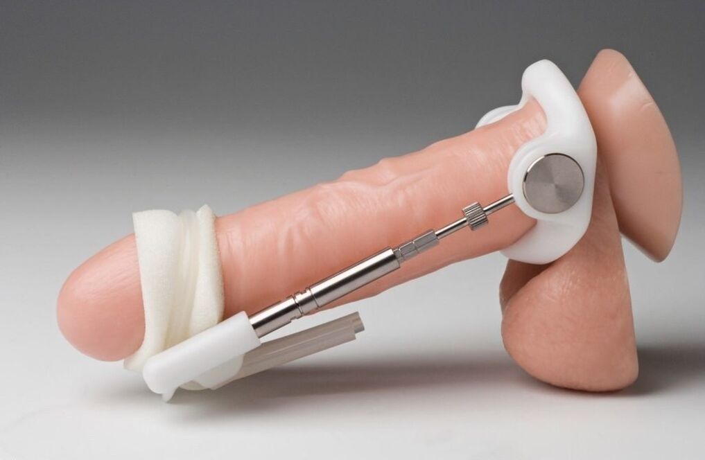 Extensor, um die Penisdicke zu erhöhen